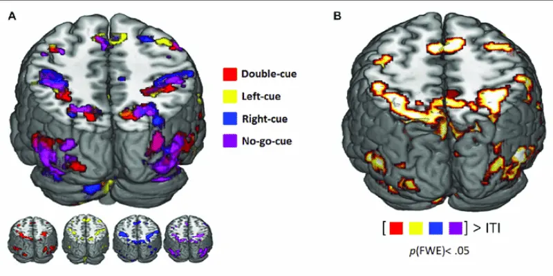 FMRI - Functional Magnetic Resonance Imaging